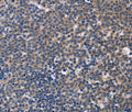 CCR6 Polyclonal Antibody – Figure 1 of 3