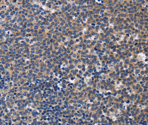 CCR6 Polyclonal Antibody – Figure 1 of 3