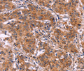 MMP14 Polyclonal Antibody – Figure 1 of 3