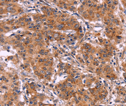 MMP14 Polyclonal Antibody – Figure 1 of 3