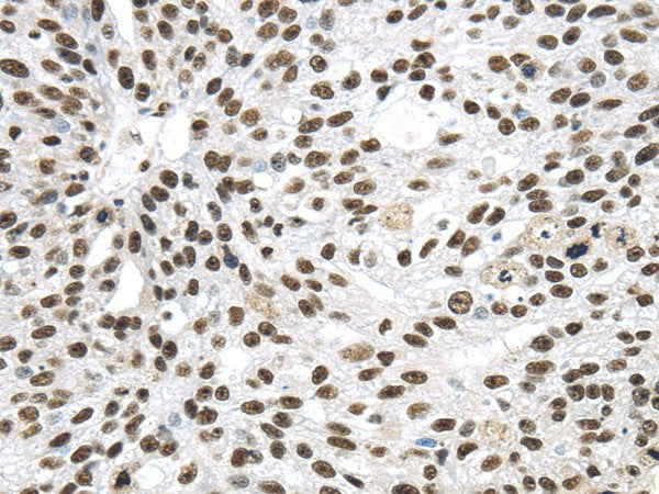 DDX39B Polyclonal Antibody – Figure 1 of 3