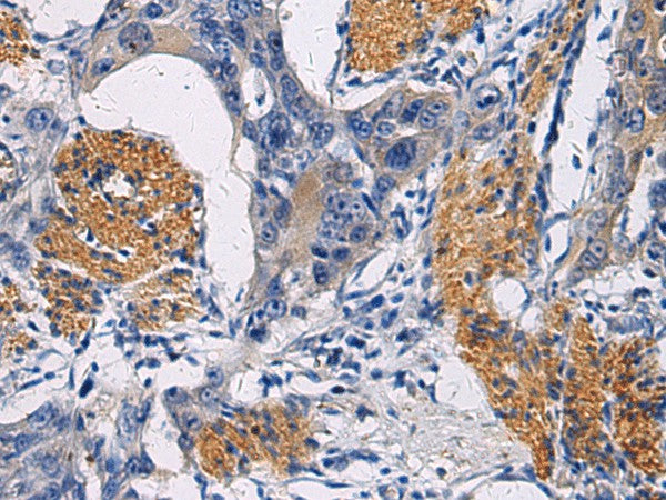 FAM20C Polyclonal Antibody – Figure 1 of 2