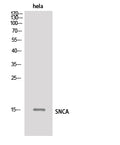 SNCA Polyclonal Antibody – Figure 1 of 4