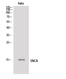 SNCA Polyclonal Antibody – Figure 1 of 4