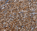 DCAF6 Polyclonal Antibody – Figure 1 of 3