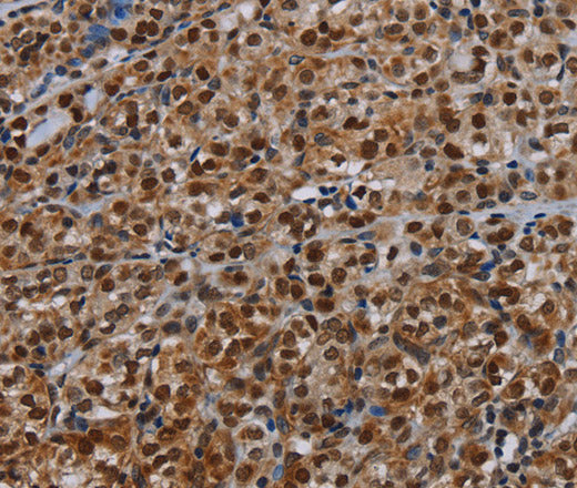 DCAF6 Polyclonal Antibody – Figure 1 of 3