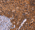CDC5L Polyclonal Antibody – Figure 1 of 3