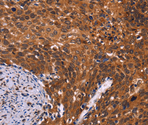 CDC5L Polyclonal Antibody – Figure 1 of 3