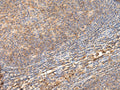 ADGRA1 Polyclonal Antibody – Figure 1 of 2