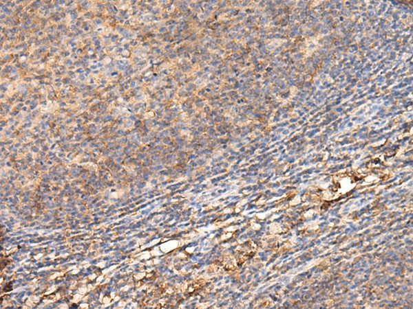 ADGRA1 Polyclonal Antibody – Figure 1 of 2