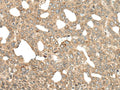 APC Polyclonal Antibody – Figure 1 of 3