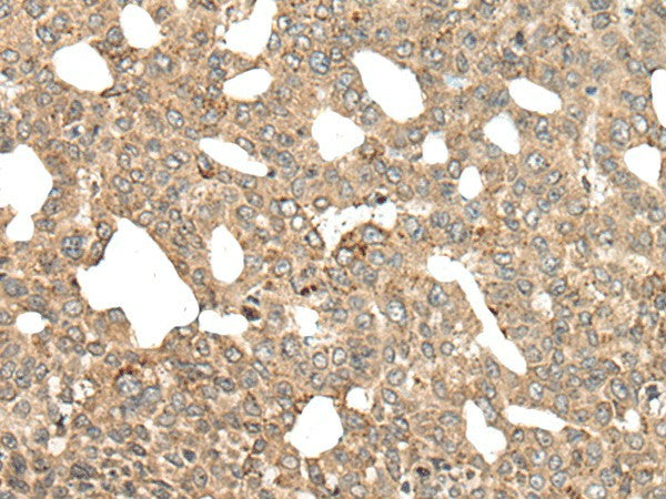 APC Polyclonal Antibody – Figure 1 of 3