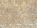 NAPRT Polyclonal Antibody – Figure 1 of 3