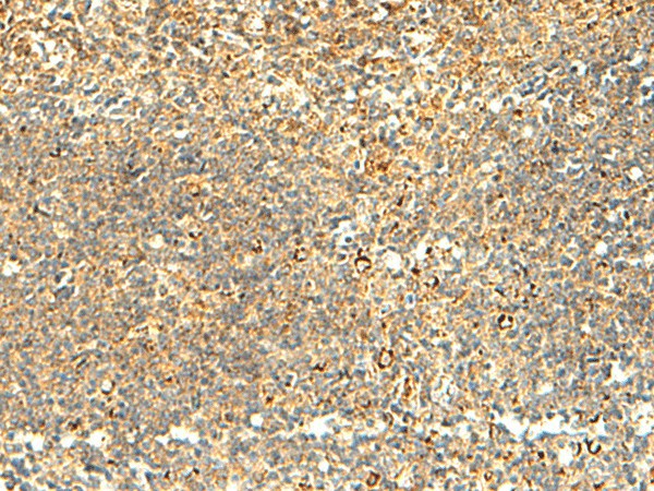 NAPRT Polyclonal Antibody – Figure 1 of 3