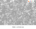 U-87 MG Cells – Figure 1 of 1