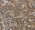 KIF4A Polyclonal Antibody – Figure 1 of 3
