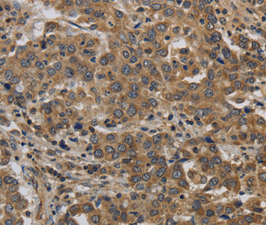 KIF4A Polyclonal Antibody – Figure 1 of 3