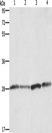 BCAP31 Polyclonal Antibody – Figure 1 of 4