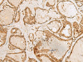 H3F3B Polyclonal Antibody – Figure 1 of 3