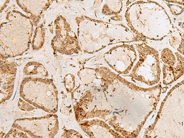 H3F3B Polyclonal Antibody – Figure 1 of 3