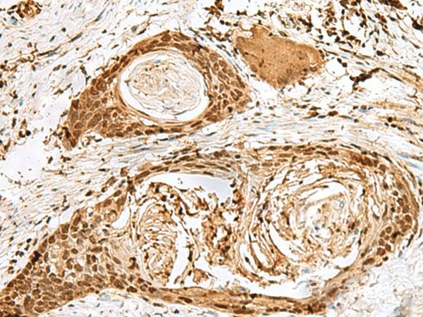 SNAPC1 Polyclonal Antibody – Figure 1 of 3