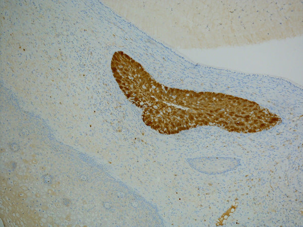 Anti-p16 (mouse monoclonal) – Figure 1 of 1