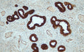 Anti-PSA (Prostate-specific antigen) – Figure 1 of 2