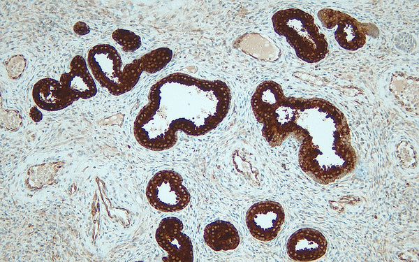Anti-PSA (Prostate-specific antigen) – Figure 1 of 2