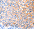 CCDC88A Polyclonal Antibody – Figure 1 of 3