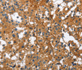 BGN Polyclonal Antibody – Figure 1 of 3