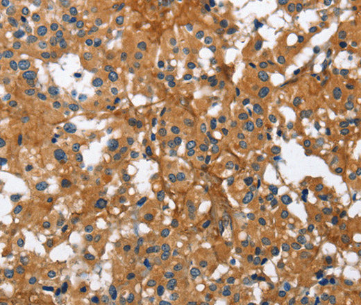 BGN Polyclonal Antibody – Figure 1 of 3