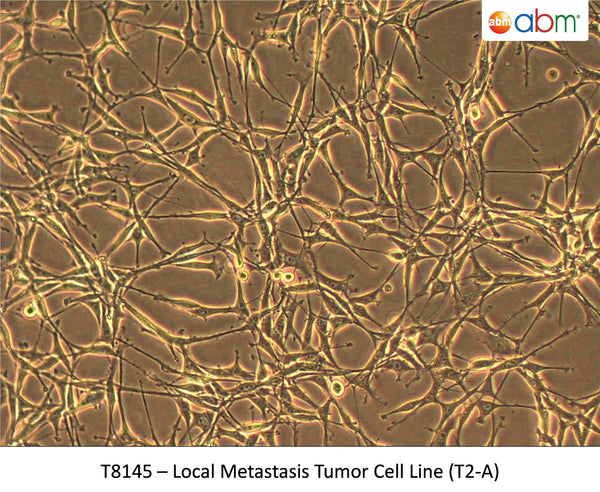 Local Metastasis Tumor Cell Line (T2-A) | Applied Biological Materials (abm)