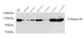 COL3A1 Polyclonal Antibody – Figure 1 of 2