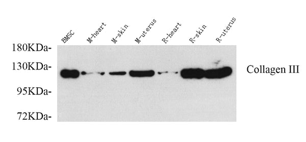 COL3A1 Polyclonal Antibody – Figure 1 of 2