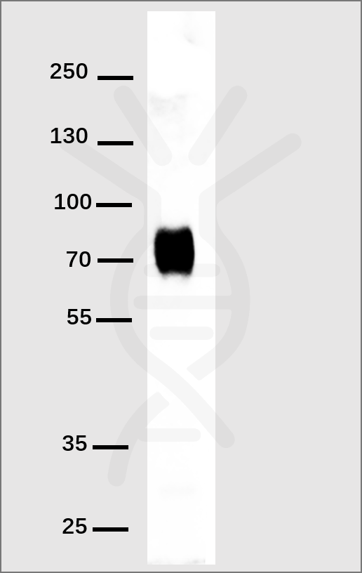Anti-His Tag antibody(DM1), Rabbit mAb – Figure 1 of 1