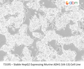 Stable HepG2 Expressing Murine ADH1 (VA-13) Cell Line | Applied Biological Materials (abm)
