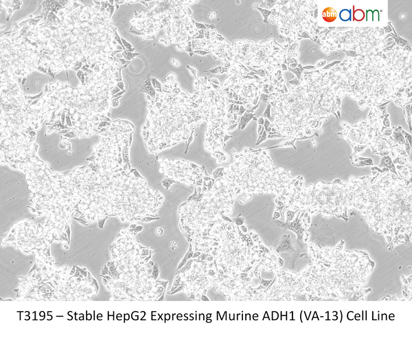 Stable HepG2 Expressing Murine ADH1 (VA-13) Cell Line | Applied Biological Materials (abm)