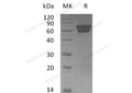 Recombinant Mouse EDAR/DL Protein (Fc Tag) – Figure 1 of 2