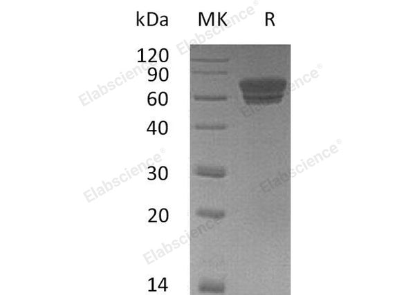 Recombinant Mouse EDAR/DL Protein (Fc Tag) – Figure 1 of 2