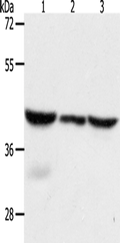 CAPG Polyclonal Antibody – Figure 1 of 4