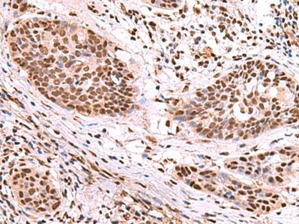 SF3B3 Polyclonal Antibody – Figure 1 of 3