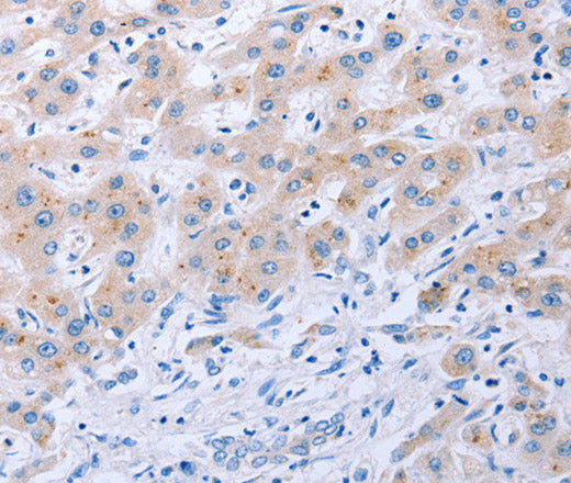 FGF4 Polyclonal Antibody – Figure 1 of 3