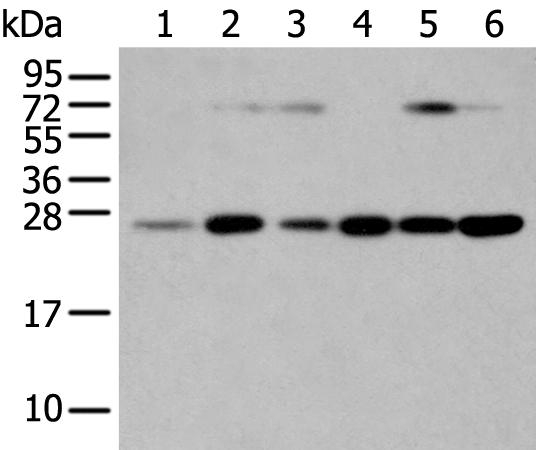 SNAP23 Polyclonal Antibody – Figure 1 of 2