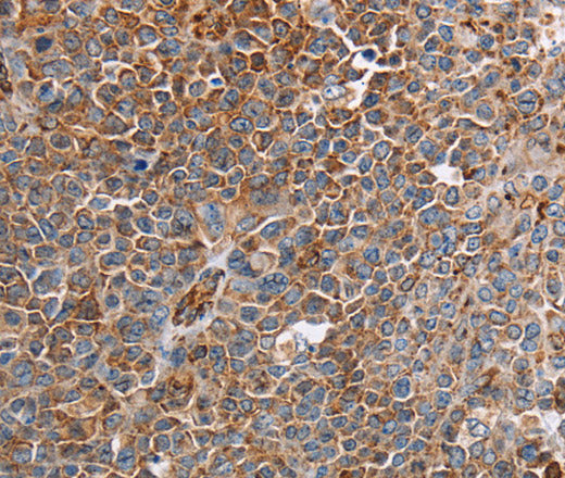 PLXNA2 Polyclonal Antibody – Figure 1 of 3