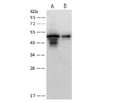 Anti-SARS-CoV Nucleoprotein / NP Polyclonal Antibody – Figure 1 of 2