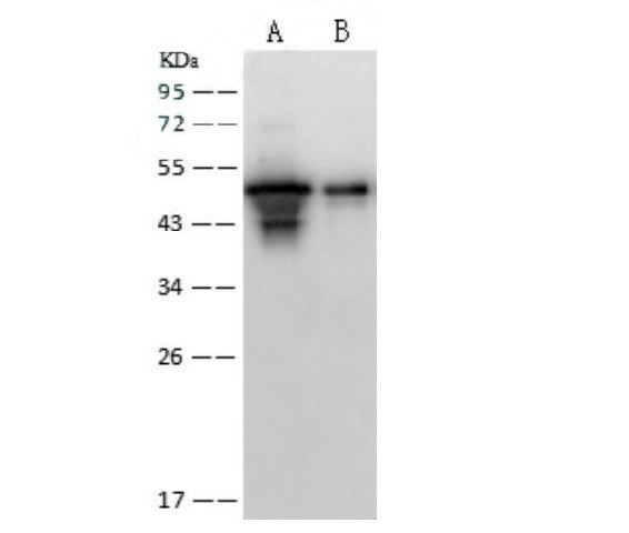Anti-SARS-CoV Nucleoprotein / NP Polyclonal Antibody – Figure 1 of 2