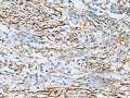 DPYSL3 Polyclonal Antibody – Figure 1 of 3