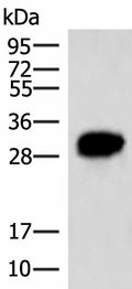 HCCS Polyclonal Antibody – Figure 1 of 4