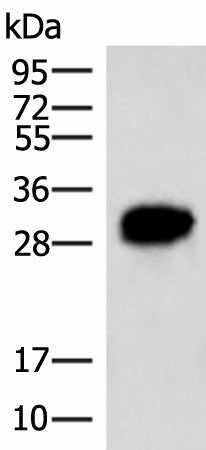 HCCS Polyclonal Antibody – Figure 1 of 4
