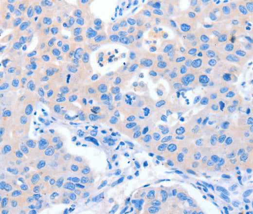 NUAK1 Polyclonal Antibody – Figure 1 of 2